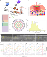 Công nghệ đo đường huyết không cần chích lấy máu