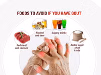Những thực phẩm cần tránh khi bị bệnh gout