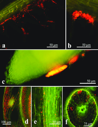Vi khuẩn nguy hại sinh sôi trong lò vi sóng gia đình