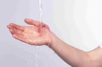 [Ảnh] Nhận diện những dấu hiệu tổn thương do kiến ba khoang và cách xử lý 