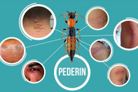 [Ảnh] Nhận diện những dấu hiệu tổn thương do kiến ba khoang và cách xử lý 