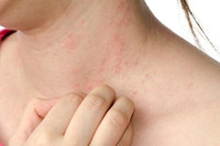 [Ảnh] Nhận diện những dấu hiệu tổn thương do kiến ba khoang và cách xử lý 