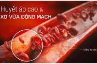 [Ảnh] Lợi ích không ngờ tới của việc ngủ sớm, ngủ đủ giấc