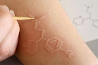 [ẢNH] Kỳ lạ chứng da vẽ nổi xuất hiện trên cơ thể con người 