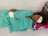 [Ảnh] Loài chó dữ Pitbull vừa cắn chết người ở Long An hung bạo ra sao?