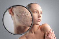 [Ảnh] Mẹo chữa trị nẻ môi, nẻ da mặt hiệu quả trong mùa hanh khô 