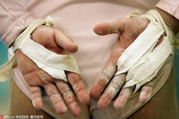 [ẢNH] Vận động viên nhí Trung Quốc đổi máu và nước mắt cho ‘giấc mơ vàng' Olympic