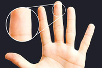 [ẢNH] Giải mã bí ẩn về những người không có dấu vân tay