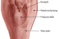 [ẢNH] Sự nguy hiểm khôn lường của ung thư hạ họng