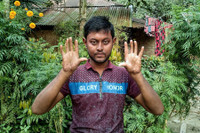 [ẢNH] Giải mã bí ẩn về những người không có dấu vân tay