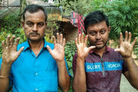 [ẢNH] Giải mã bí ẩn về những người không có dấu vân tay