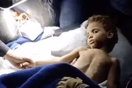 Bé trai sống sót thần kỳ sau 6 ngày dưới đống đổ nát ở Venezuela