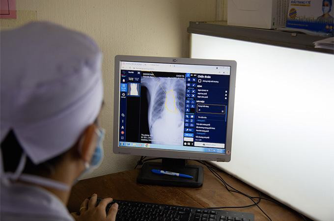 Bác sĩ sử dụng DrAid™ trong chẩn đoán hình ảnh