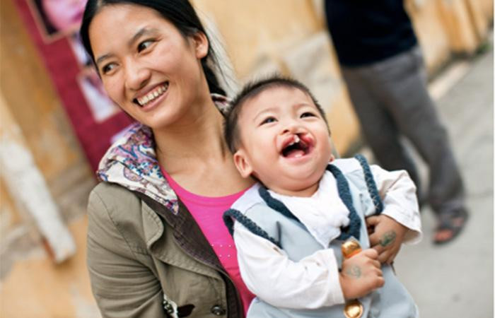 Cùng giúp tạo nên nụ cười mới đầy hồn nhiên và trong sáng này của các em qua những chiếc bánh su kem của Beard Papa’s (Nguồn: Operation Smile Việt Nam)