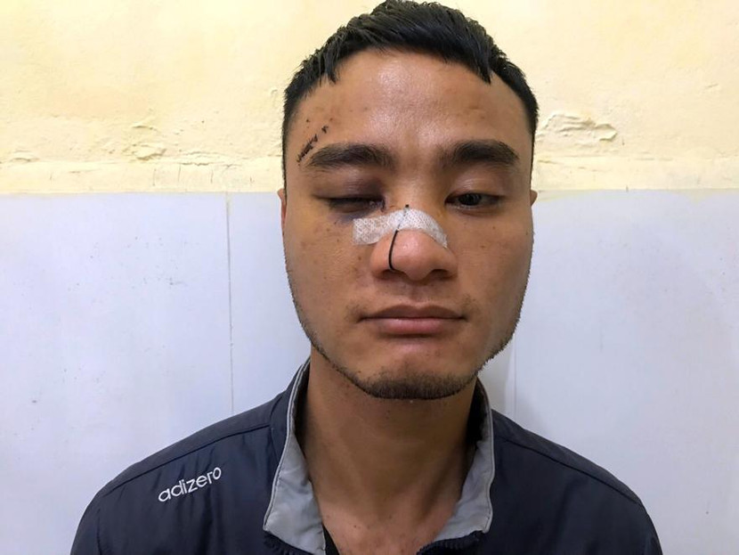 Đối tượng Nguyễn Quang Dương