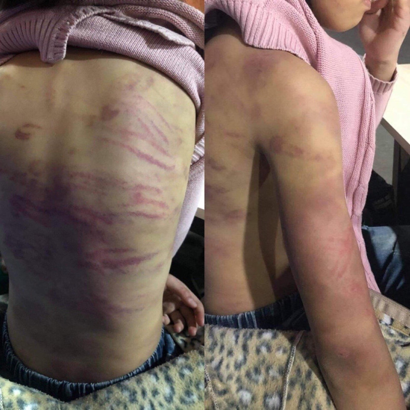 Hình ảnh bé gái Nguyễn Hải B. được cho là bị mẹ đẻ, và "người tình" của mẹ bạo hành Hình ảnh bé gái Nguyễn Hải B. được cho là bị mẹ đẻ, và "người tình" của mẹ bạo hành