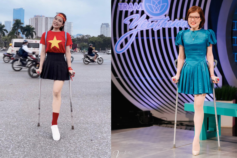 "Hoa khôi 1 chân" Bế Thị Băng với nghị lực phi thường "Hoa khôi 1 chân" Bế Thị Băng với nghị lực phi thường