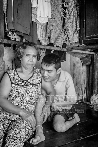 Người phụ nữ can trường, 32 năm “nuốt nước mắt” nuôi con tật nguyền ảnh 8