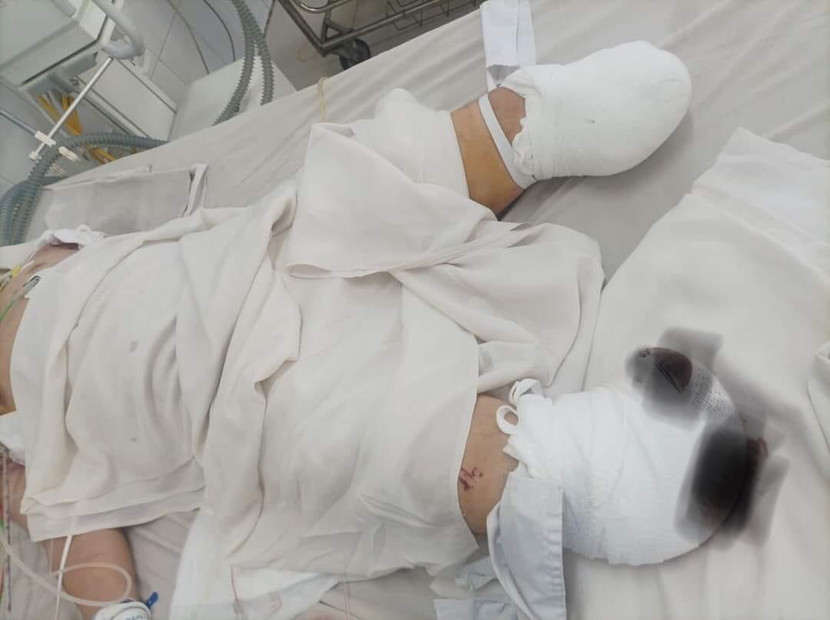 Nạn nhân bị thương tích nghiêm trọng, đang cấp cứu tại bệnh viện