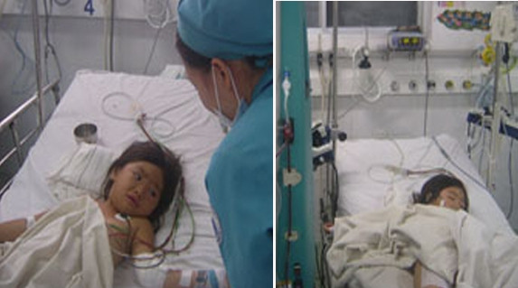 Bé D. đang nằm điều trị tại BV (Ảnh BV Nhi đồng 1) Bé D. đang nằm điều trị tại BV (Ảnh BV Nhi đồng 1)