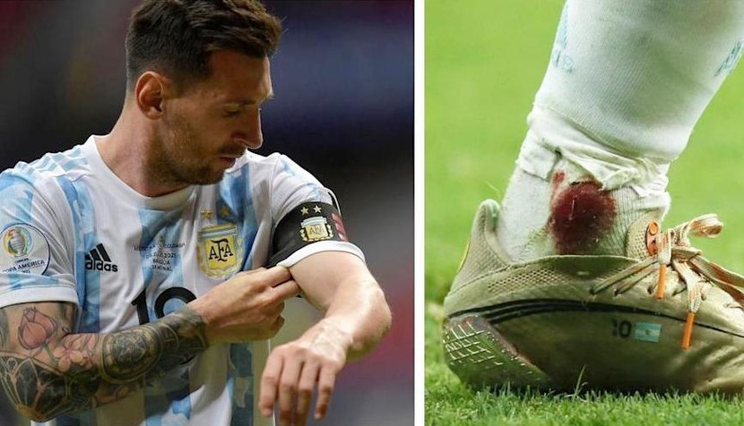 Cổ chân rỉ máu của Messi ở trận bán kết với Colombia