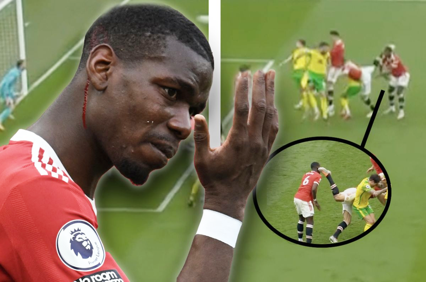 Pogba chảy máu sau khi bị Maguire vô tình đá phải