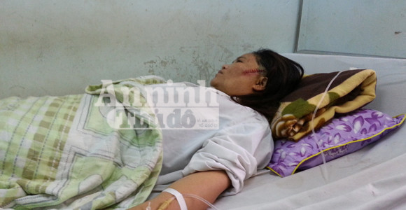 Bố chồng ẩu đả, chém biến dạng mặt nàng dâu ảnh 1