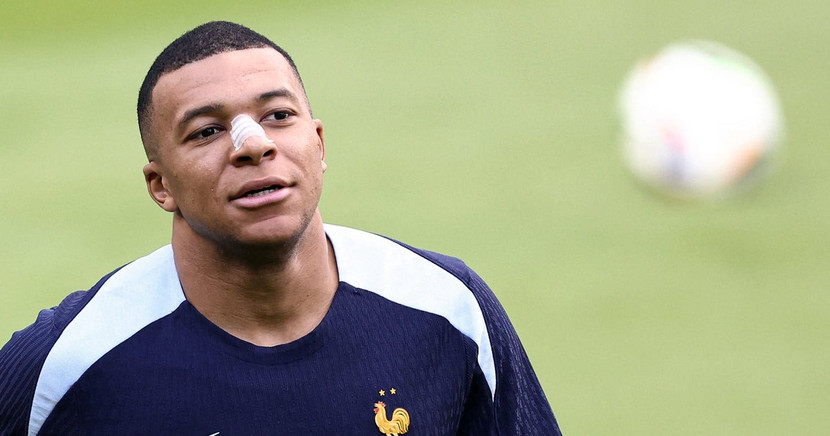 Hình ảnh mới nhất của Mbappe sau chấn thương vùng mũi