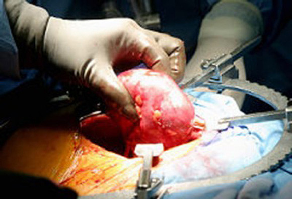 Cơ hội để hạn chế nạn mua bán nội tạng người ảnh 1