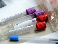 Nếu xảy ra đại dịch, thế giới có thể mất đi 33 triệu người chỉ trong 6 tháng