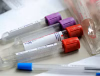 Nếu xảy ra đại dịch, thế giới có thể mất đi 33 triệu người chỉ trong 6 tháng