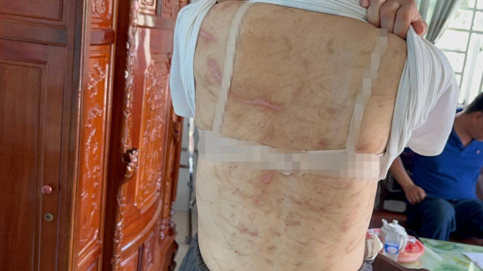 Những vết thương chi chít, chằng chịt trên cơ thể của người vợ