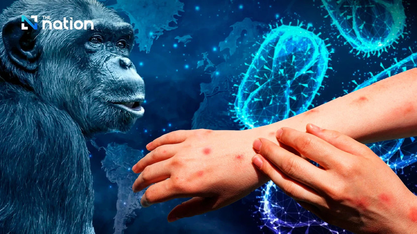 Tổ chức Y tế Thế giới khẳng định bệnh đậu mùa khỉ không gây ra mối đe dọa sức khỏe cộng đồng giống như Covid-19 Tổ chức Y tế Thế giới khẳng định bệnh đậu mùa khỉ không gây ra mối đe dọa sức khỏe cộng đồng giống như Covid-19