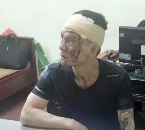 Đối tượng Hiệp tại Cơ quan điều tra Đối tượng Hiệp tại Cơ quan điều tra