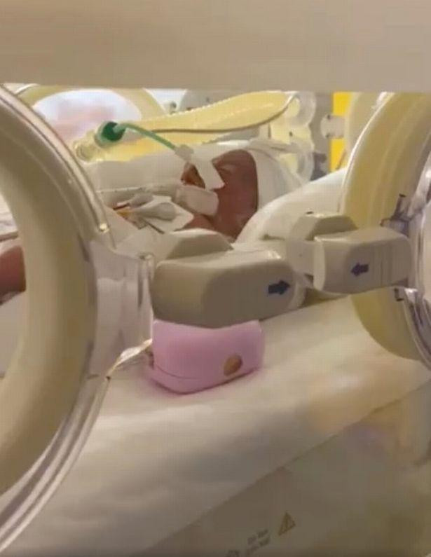 Các em bé sinh non được đặt trong lồng kính để theo dõi sức khỏe