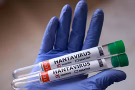 Cập nhật năng lực xét nghiệm virus Hanta, cảnh báo nguy cơ từ chuột