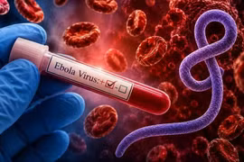 Siết kiểm soát dịch Ebola tại các cơ sở y tế, theo dõi người về từ vùng dịch
