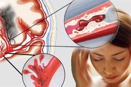 Thói quen phổ biến vào mùa lạnh làm tăng nguy cơ đột tử 