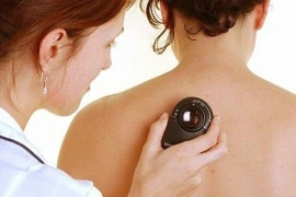 Những dấu hiệu ung thư dễ bị bỏ qua 