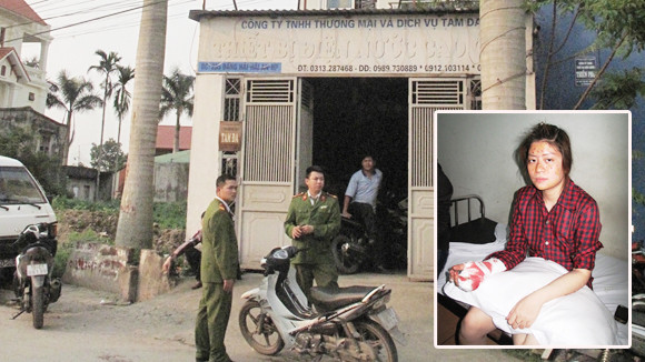 Nữ kế toán bị thương nặng vì “bom thư” ảnh 1 Nữ kế toán bị thương nặng vì “bom thư” ảnh 1