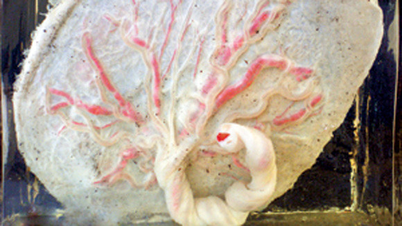 Nhau thai bà đẻ được tuồn ra ngoài bằng đường nào? ảnh 1 Nhau thai bà đẻ được tuồn ra ngoài bằng đường nào? ảnh 1