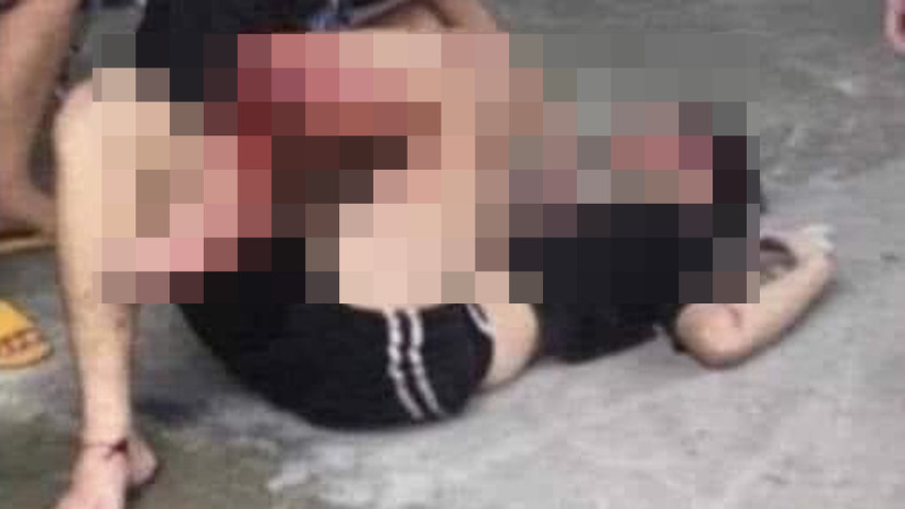 Nam thanh niên đang đổ xăng thì bất ngờ bị xe máy phóng tốc độ cao tông gãy chân. Ảnh: FB