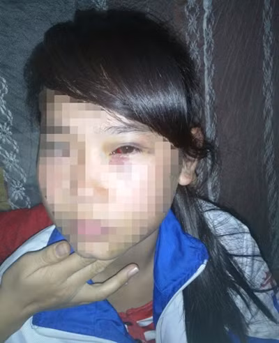 Không chịu “chơi trò người lớn”, nữ sinh lớp 9 bị gã trai mới lớn cưỡng hiếp dã man ảnh 2