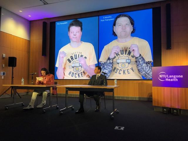 Joe DiMeo tại buổi họp báo cùng bức ảnh trước và sau phẫu thuật