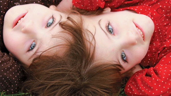 Chuyện lạ có thật về bộ não con người ảnh 4