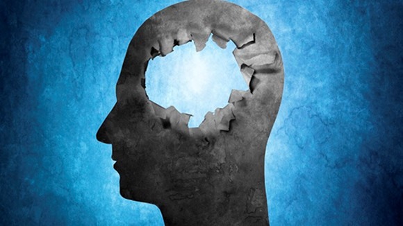 Chuyện lạ có thật về bộ não con người ảnh 3