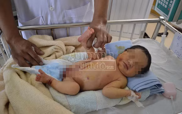 Bé gái 10 ngày tuổi bị bỏ rơi ở bụi tre, dòi, kiến bâu đầy người ảnh 1