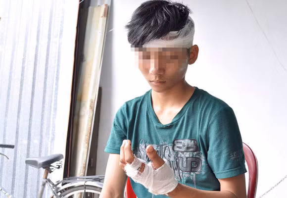 Bắt giam 10 đối tượng xông vào trụ sở ỦBND phường đánh người ảnh 1