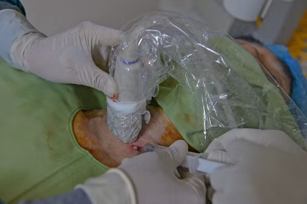 Các bác sĩ vừa chọc hút dịch vừa bơm cồn tuyệt đối để điều trị nang giáp cho bệnh nhân