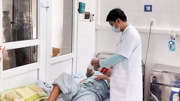 Một bệnh nhân bị bỏng do nướng mực bằng cồn điều trị tại BV Xanh Pôn